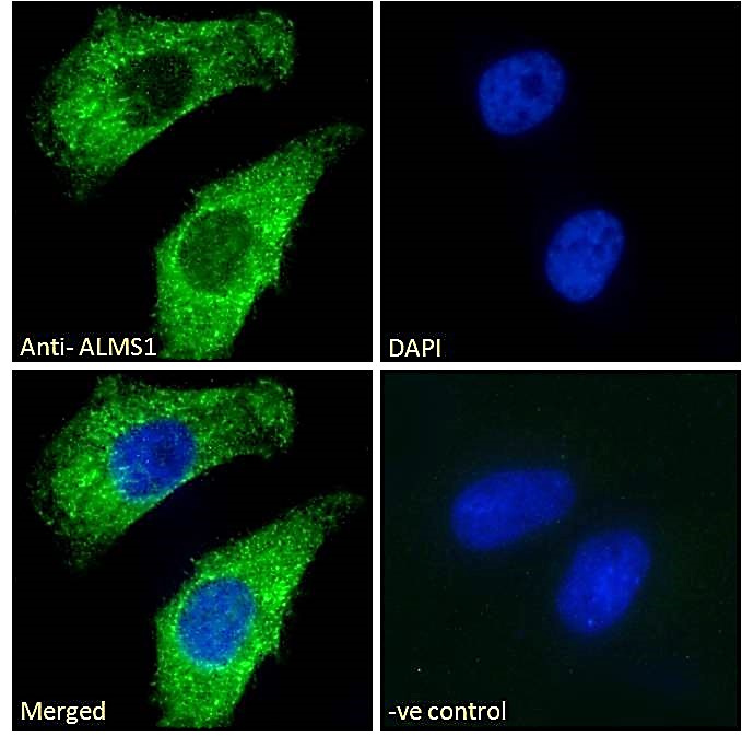 ALMS1 antibody