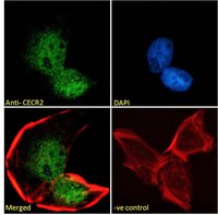 CECR2 Antibody