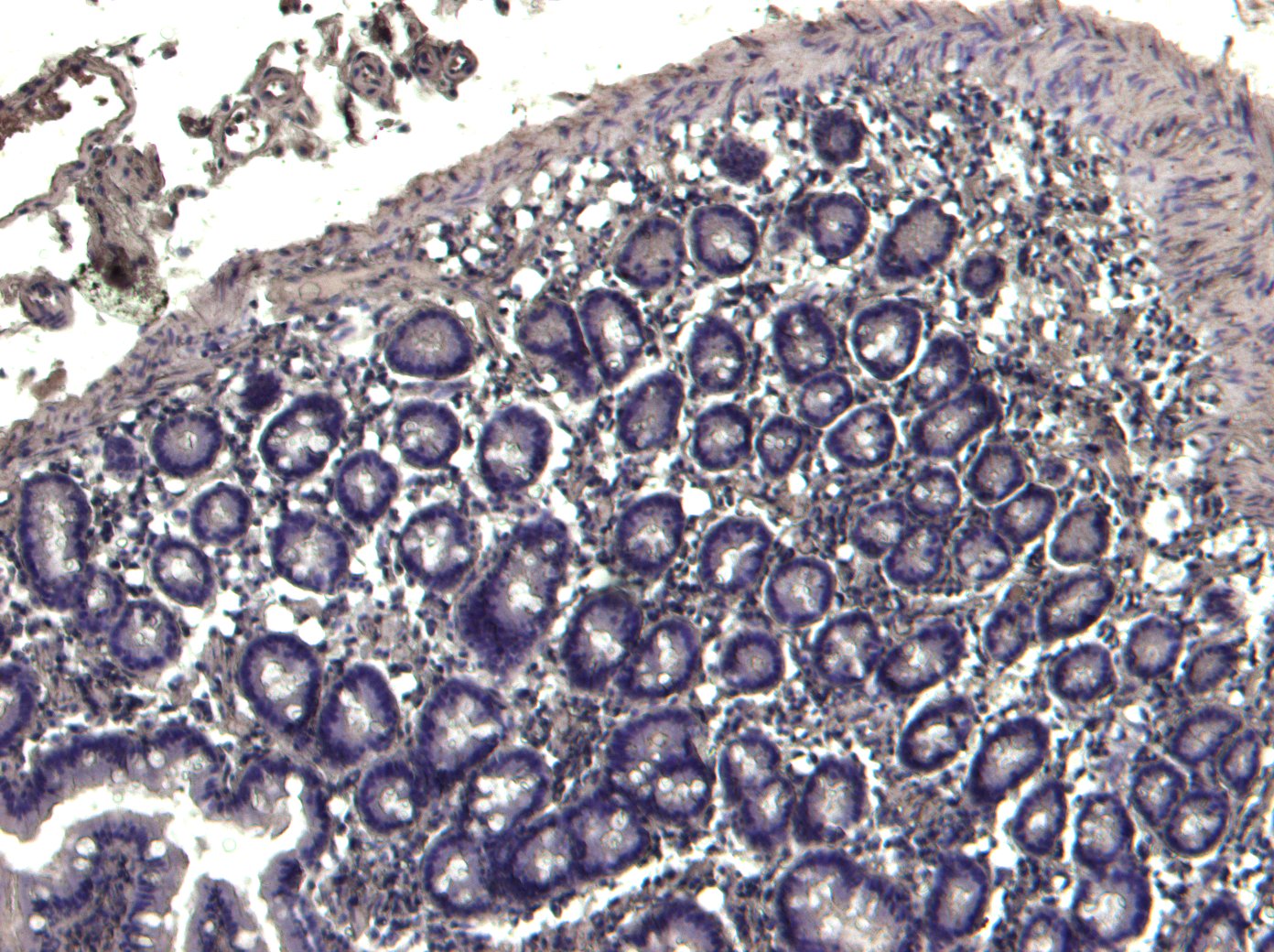 Goat anti-TRIM5 / RNF88 Antibody