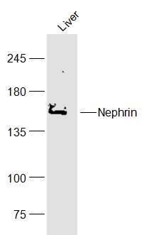 Nephrin antibody