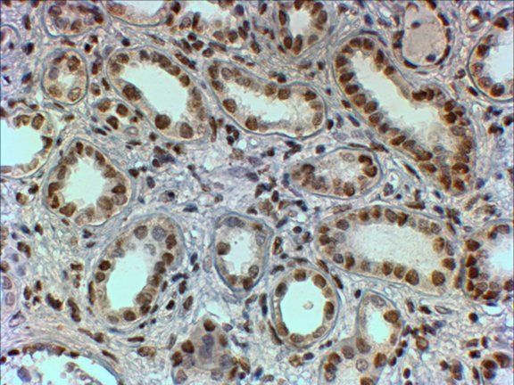 PTBP1 antibody