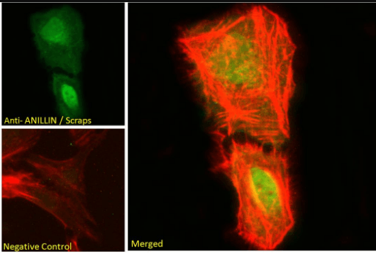 Goat anti-ANILLIN / Scraps (C Terminus) Antibody