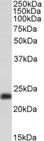 Goat anti-SM22 Alpha / Transgelin Antibody