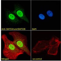 Goat anti-BAF53A and BAF53B Antibody