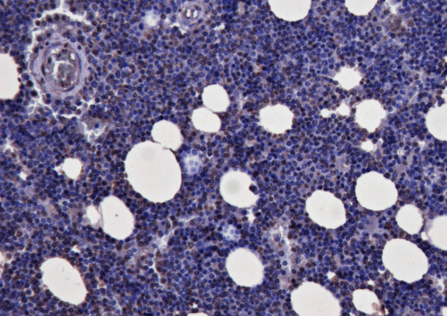 Goat anti-KLF1 / EKLF Antibody