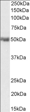 CD274 antibody