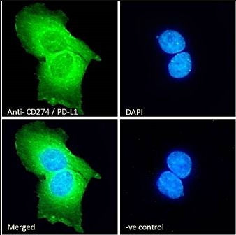 CD274 antibody