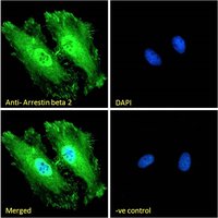 ARRB2 antibody