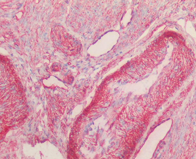Goat anti-Caveolin 1 Antibody