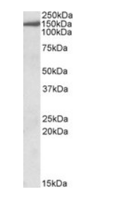 Goat anti-EPB41L3 / DAL1 Antibody