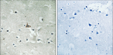Trk B (Phospho-Tyr706/Tyr707) Antibody