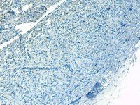 Goat anti-ADRB1 Antibody