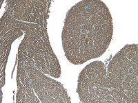 Goat anti-ADRB1 Antibody