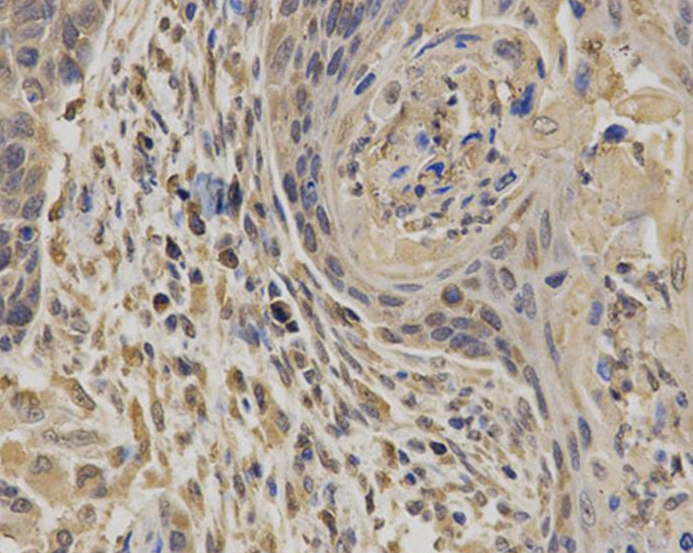 EPHX1 Antibody