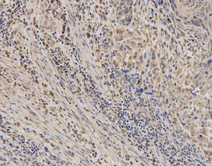 EPHX1 Antibody
