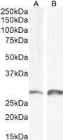 Snail homolog 1/SNAI1 Antibody