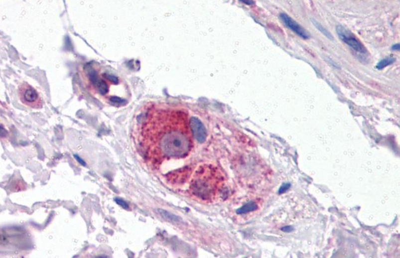 Goat anti-CYP26B1 Antibody