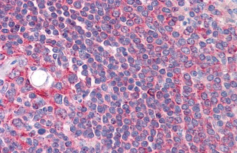 Goat anti-CYP26B1 Antibody