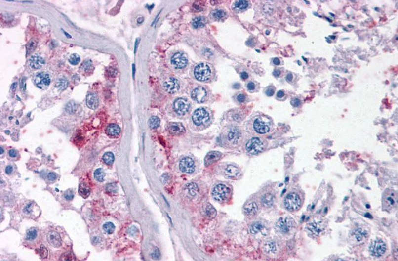 Goat anti-CYP26B1 Antibody