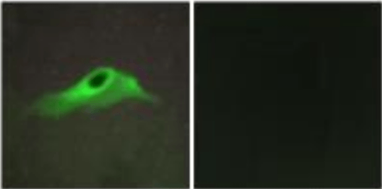 Collagen IV α5 Antibody