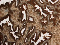 Goat anti-KLK2 Antibody