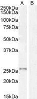 Goat anti-KLK2 Antibody