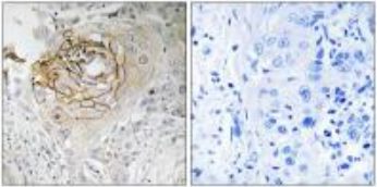 SCN9A Antibody