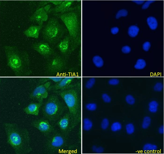 Goat anti-TIA1 Antibody
