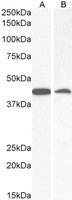 Goat anti-AMACR Antibody