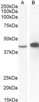 Goat anti-AMACR Antibody