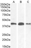 AMACR antibody