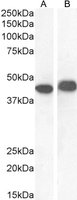 AMACR antibody