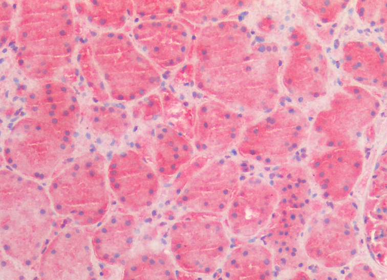 Goat anti-AMACR (aa312-326) Antibody