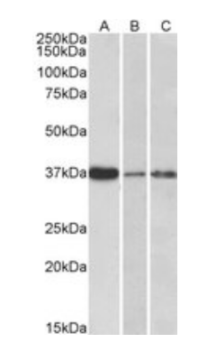 IL12 p40 antibody
