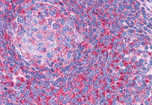 Goat anti-TPD52L2 / D54 Antibody