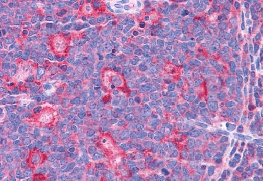 Goat anti-TPD52L2 / D54 Antibody
