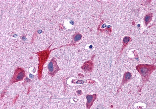 Goat anti-TPD52L2 / D54 Antibody