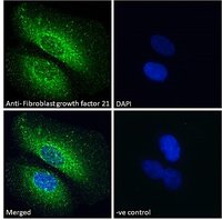 Fibroblast growth factor 21 antibody