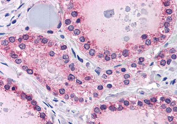 Goat anti-PTPRM Antibody