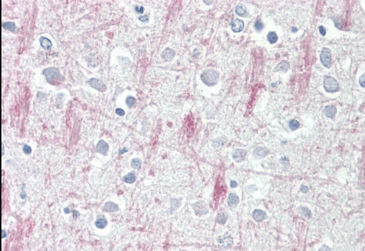 Goat anti-GPR125 Antibody