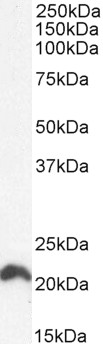 NRAS antibody