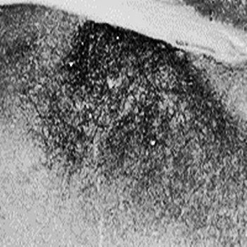 Goat anti-Proenkephalin (mouse) Antibody