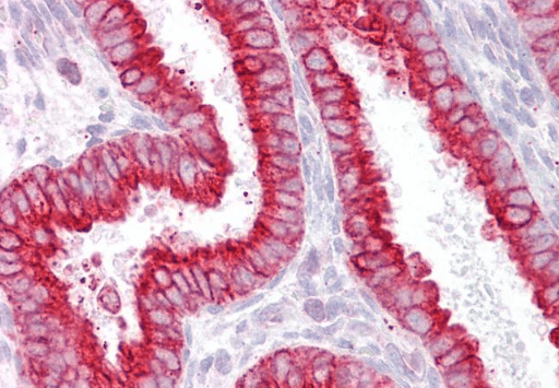 Goat anti-CHRNB2 Antibody
