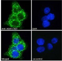 AGXT antibody