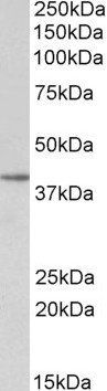 SFRP4 antibody