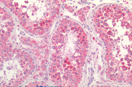 Calnexin antibody