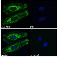 Goat anti-TGFBI Antibody
