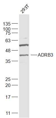 beta 3 Adrenergic Receptor antibody