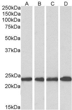 Goat anti-MNSOD (aa119-130) Antibody