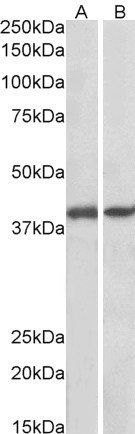 Goat anti-GNAQ / ALPHA-q (aa162-175) Antibody